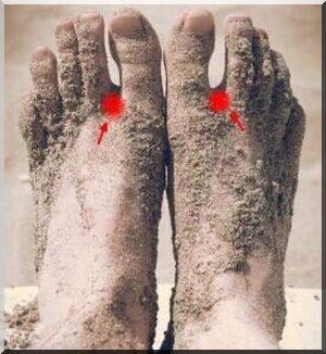 acupression pied