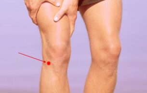 knee point restless legs syndrome