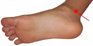 points d'acupression pieds SJSR