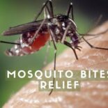 best remedies for mosquito bites