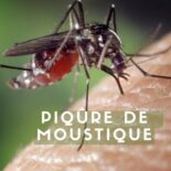 démangeaison piqure moustique tigre