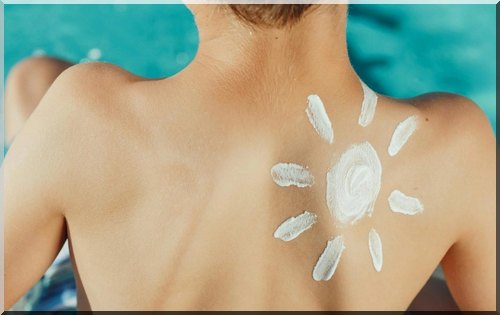 what to do for a sunburn