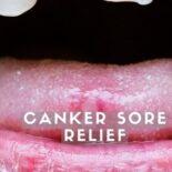 mouth rinse for mouth sores
