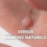 comment se débarrasser des verrues