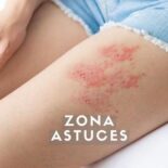qu'est-ce qui déclenche un zona