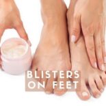 how to get rid of blisters