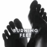 home treatment for burning feet