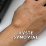 traitement du kyste synovial