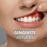 gingivite traitement naturel