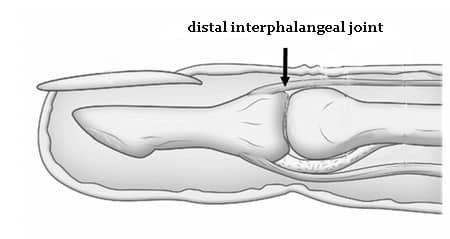 pain in fingers