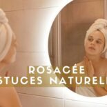 rosacée traitement naturel