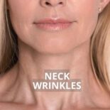 how to tighten neck skin naturally