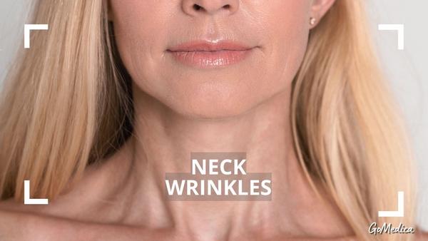 how to tighten neck skin naturally