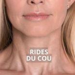 comment raffermir la peau du cou