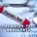 bilan sanguin thyroïde