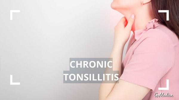 how to get rid of tonsillitis