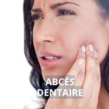 comment soigner un abcès sur la gencive
