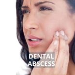 how to treat a gum abscess at home