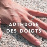 traitement naturel arthrose des doigts
