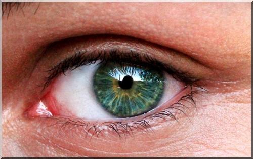 eye rosacea natural treatment