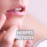 comment soigner un herpès