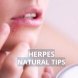 how to heal herpes sores faster