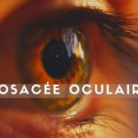 rosacée oculaire