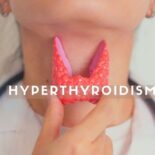 natural remedies for hyperthyroidism