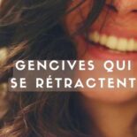 régénérer gencive naturellement