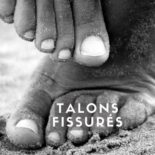 fissures des pieds