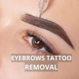 microblading tattoo removal