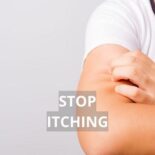 what to do for itchy skin