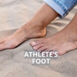effective natural remedies to treat athlete's foot at home
