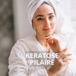 10 Remèdes Naturels Contre la Kératose Pilaire (Peau de Poulet)
