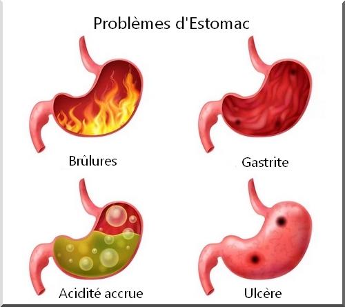 symptome de probleme d'estomac